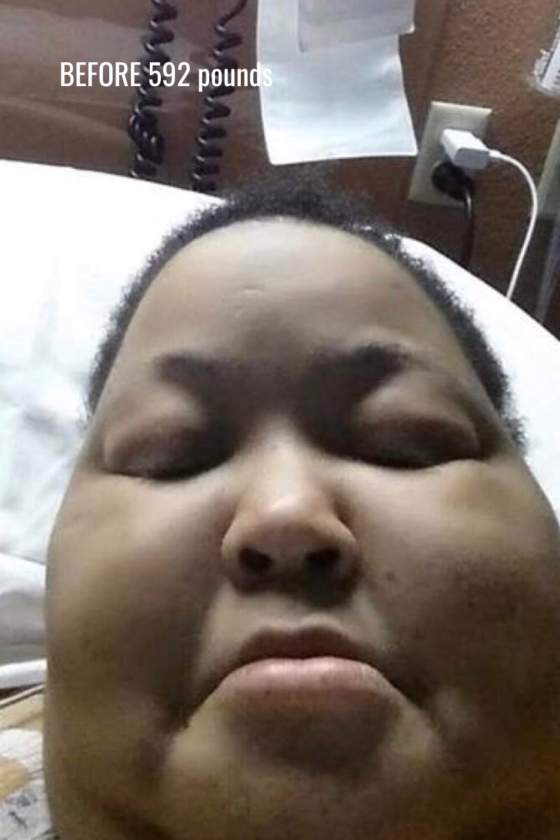 Unbig Your Back 21 Day Guide + Meal Plan &I.R.I.S.E. Fit Kit