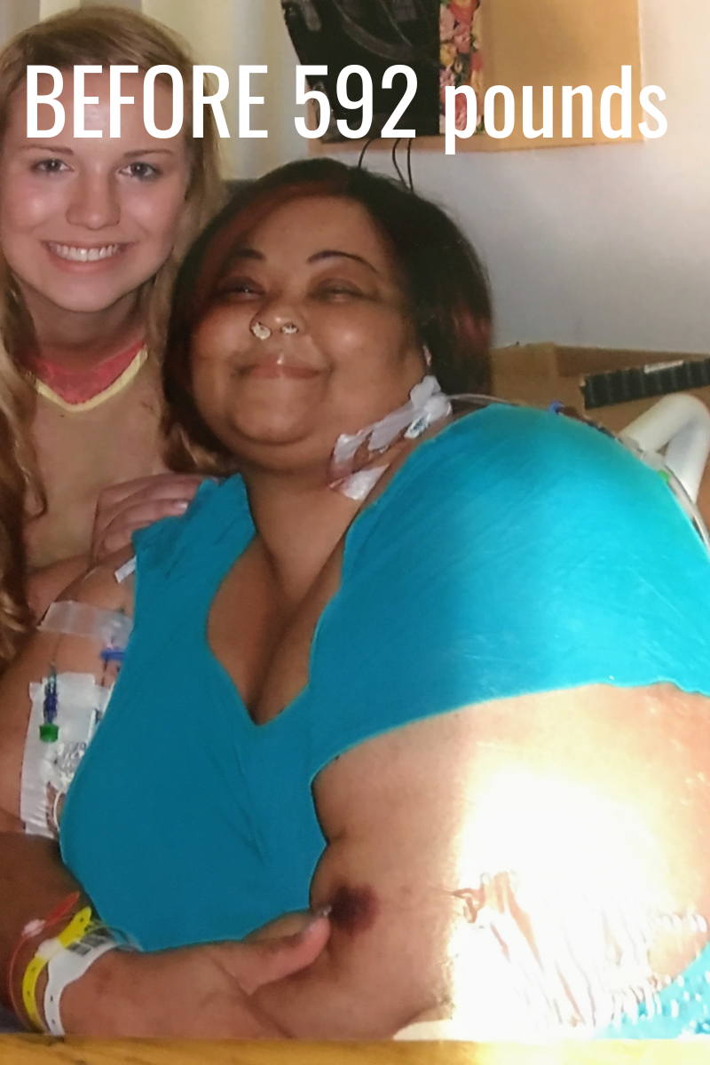 Unbig Your Back 21 Day Guide + Meal Plan &I.R.I.S.E. Fit Kit